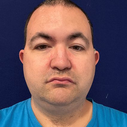 Neutral expression of a man with short hair, wearing a blue t-shirt, against a dark background.